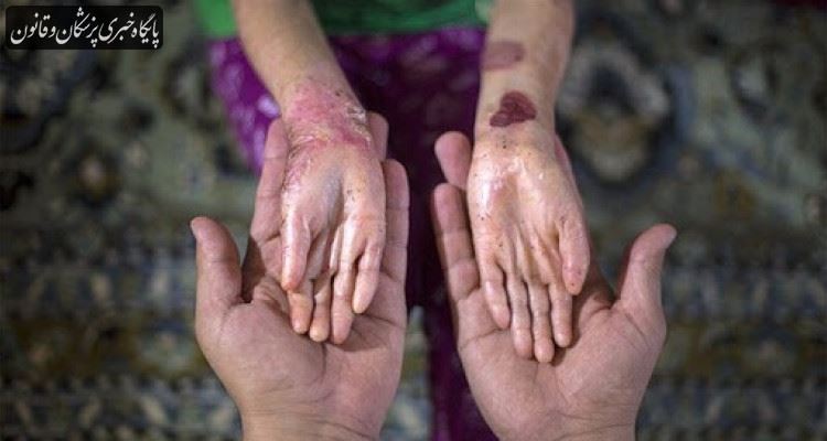 مفقود شدن ۲۵۰۰ کیلو از پانسمان بیماران ای‌بی