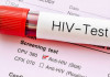 ۹۵ درصد موارد ابتلا به ایدز در کشورهای درحال توسعه رخ می دهد