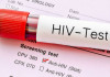 HIV چگونه منتقل می‌شود و راه‌های پیشگیری از آن چیست؟