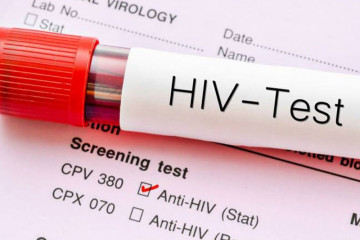تائید اولین داروی تزریقی برای پیشگیری از HIV