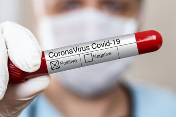 فهرست آزمایشگاه‌های تشخیص کووید ۱۹ اعلام شد