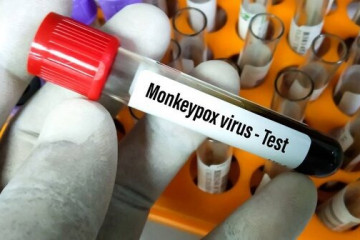 احتمال انتقال آبله میمونی از طریق هوا وجود دارد