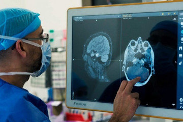 اعمال رادیولوژی پزشکان ایرانی هم سطح جهان است