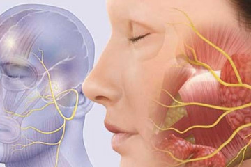 ابتلای سالانه متوسط ۸۰ هزار نفر در کشور به فلج عصب صورت
