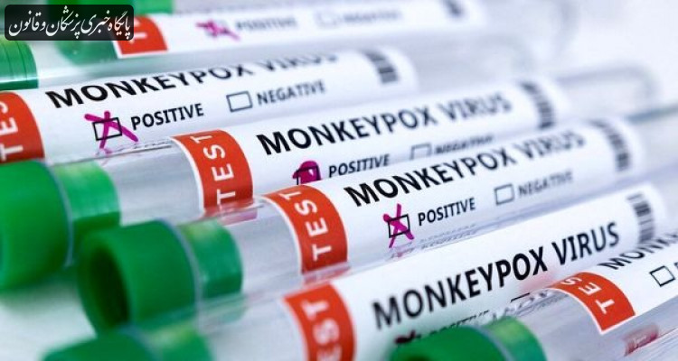 جهیز ۱۲ مرکز آزمایشگاهی در کشور جهت تشخیص آبله میمونی