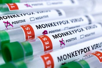 جهیز ۱۲ مرکز آزمایشگاهی در کشور جهت تشخیص آبله میمونی
