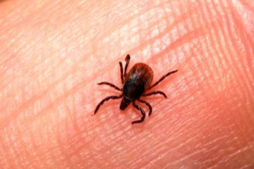 آخرین اخبار از رصد آبله میمونی در کشور