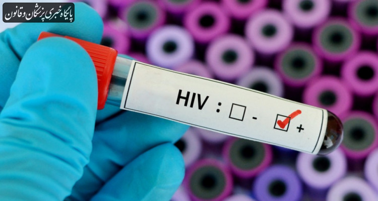 ویروس HIV فرایند پیری بدن را تسریع می کند