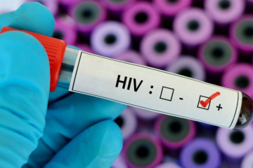 ویروس HIV فرایند پیری بدن را تسریع می کند