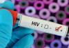 ویروس HIV فرایند پیری بدن را تسریع می کند