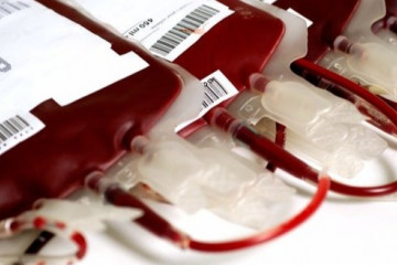 کمبود اعتبار یکی از مهمترین چالش‌های سازمان انتقال خون