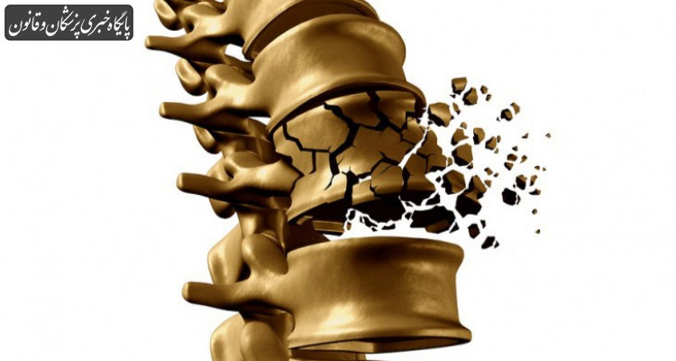مرگ سالانه ۴۲۰۰ نفر در کشور بر اثر پوکی استخوان و عوارض ناشی از آن