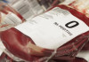 طرح "بررسی آنتی‌بادی‌های خون‌های اهدایی"