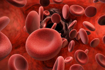 افزایش احتمالی تولد نوزاد دارای تالاسمی ماژور با محدودیت‌های غربالگری