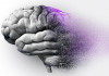 تخمین آمار یک میلیونی مبتلایان آلزایمر در ایران
