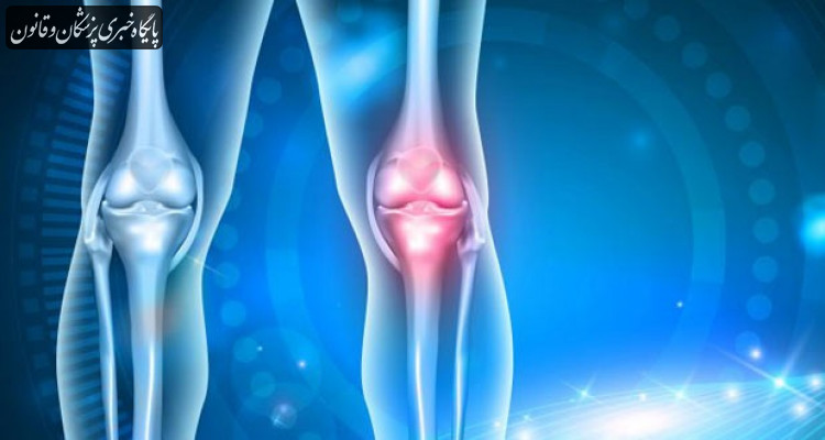 ۱۵ درصد ایرانیان از آرتروز رنج می‌برند