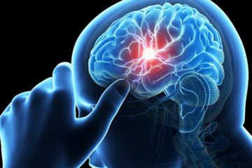 افزایش سلامت بیماران سکته مغزی با استفاده از روش مداخله‌ای