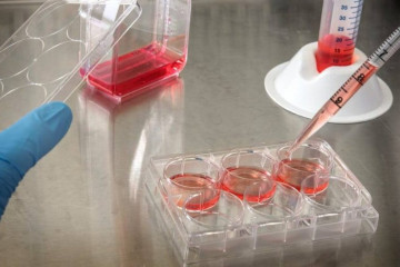 غنای کلکسیون سلولی در بانک سلولی انستیتو پاستور ایران