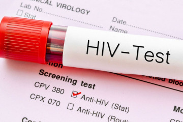 برنامه‌های ۳ و ۵ ساله وزارت بهداشت برای مدیریت HIV