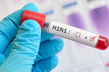 ثبت نخستین مرگ ناشی از آنفلوآنزای H۱N۱ در "گجرات" هند