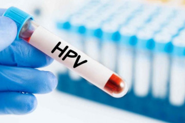 هرج و مرج در تعرفه آزمایش HPV