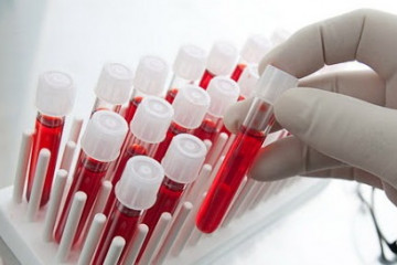 اضافه شدن آزمایش‌های "NAT" به غربالگری‌ خون‌های اهدایی