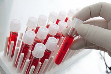 استقرار سیستمی جدید در انتقال خون و افزایش طول عمر پلاکت‌های اهدایی