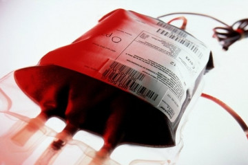فقط ۱۰ درصد از اهدا کنندگان خون دارای گروه‌های خونی منفی هستند