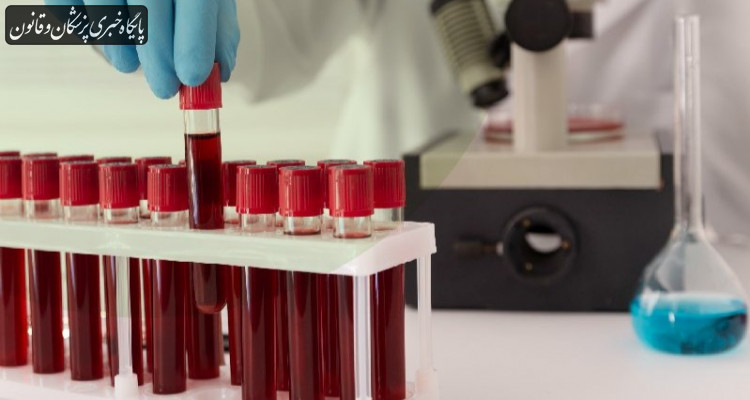 پیشرفت و فناوری های نوین انتقال خون در انتظار تامین ارزی سازمان غذا و دارو