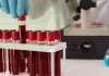 پیشرفت و فناوری های نوین انتقال خون در انتظار تامین ارزی سازمان غذا و دارو