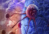 غربالگری ۲ سرطان شایع در مراکز درمانی تامین اجتماعی رایگان شد