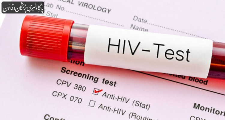 آخرین وضعیت بروز HIV در کشور