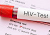 آخرین وضعیت بروز HIV در کشور