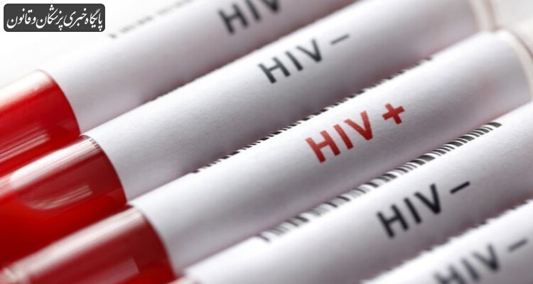اهمیت تشخیص زودرس HIV جهت درمان و پیشگیری از ورود به مرحله ایدز اهمیت تشخیص زودرس HIV جهت درمان و پیشگیری از ورود به مرحله ایدز