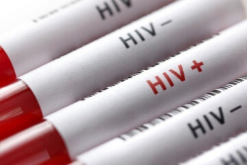 شناسایی ۲۴ هزار بیمار مبتلا به HIV