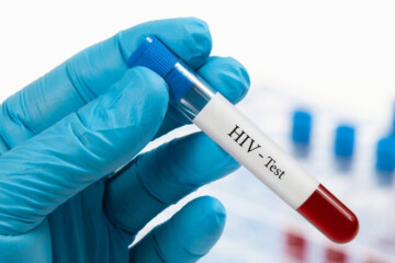 ۷۲ ساعت زمان طلایی برای کنترل محرمانه عفونت HIV