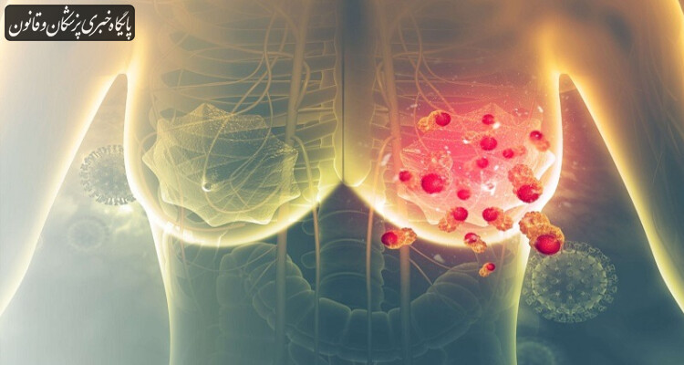 افزایش امیدها برای مهار سرطان پستان