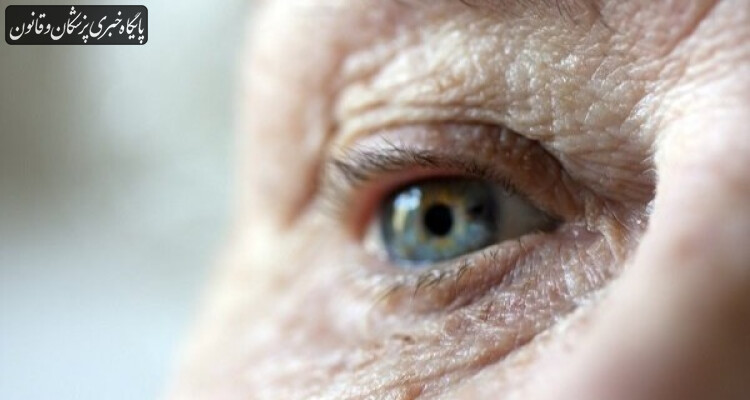 ابتلای ۲۸۸ میلیون نفر به بیماری چشمی دژنراسیون ماکولا تا سال ۲۰۴۰