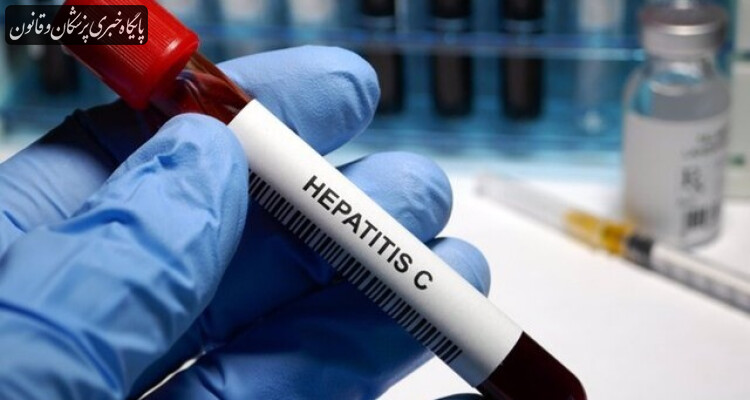 حدود ۲۰۰ هزار نفر در کشور مبتلا به هپاتیت C هستند