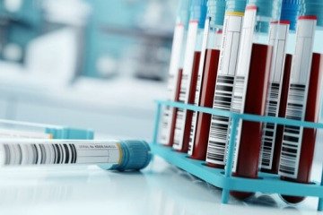 حذف انتقال ویروس‌های خطرناک از طریق خون با آزمایش مولکولی