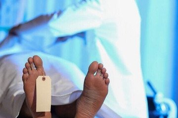 کار در پزشکی قانونی برای پزشکان صرفه اقتصادی و جذابیت ندارد