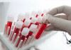 میزان بالا "پلی کلرو بی فنیل" در خون منجر به مرگ زودهنگام می‌شود