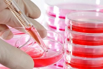 استفاده از سلول‌های بنیادی خون‌ساز برای درمان ۸۰ بیماری‌ خونی