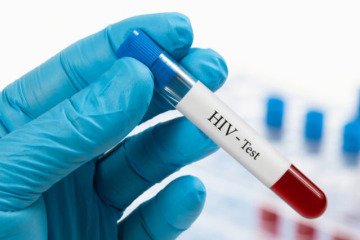 تست HIV در مراکز دولتی کاملاً رایگان و محرمانه است
