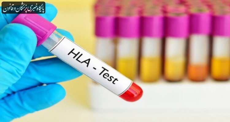 ضرورت توجه به قومیتها برای تقویت بانک اطلاعاتی HLA جهت پیوند سلولهای بنیادی ضرورت توجه به قومیتها برای تقویت بانک اطلاعاتی HLA جهت پیوند سلولهای بنیادی
