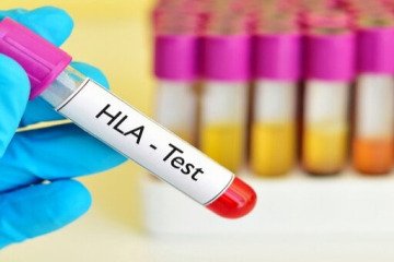 ضرورت توجه به قومیت‌ها برای تقویت بانک اطلاعاتی HLA جهت پیوند سلول‌های بنیادی