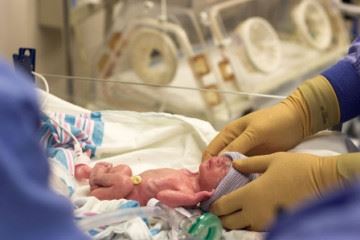 یک هفتم نوزادان در جهان هنگام تولد دچار کم‌وزنی هستند