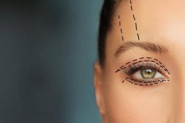 افزایش تقاضا برای جراحی زیبایی پلک در کشور