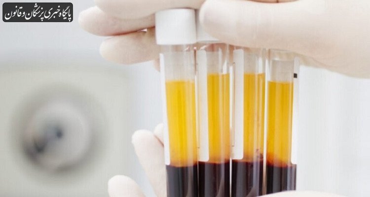فروپاشی اهدای داوطلبانه خون با گسترش پلاسمای پولی فروپاشی اهدای داوطلبانه خون با گسترش پلاسمای پولی