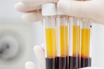 فروپاشی اهدای داوطلبانه خون با گسترش پلاسمای پولی
